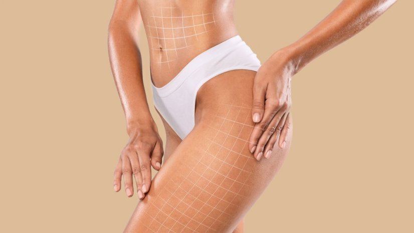 Body Correct. Krém proti striím 150ml   021202